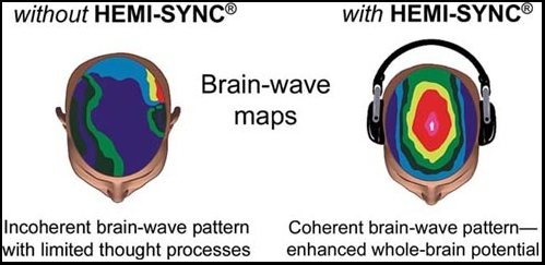 2-brains